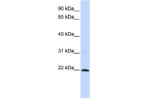 WB Suggested Anti-ZNF581 Antibody Titration:  0.