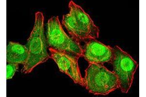 Immunocytochemistry (ICC) image for anti-RAN, Member RAS Oncogene Family (RAN) (AA 1-216) antibody (ABIN5876159) (RAN antibody  (AA 1-216))