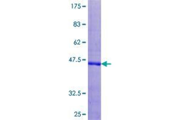 UCN3 Protein (AA 1-161) (GST tag)