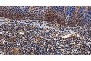 Immunohistochemistry of paraffin-embedded Human tonsil tissue using LRRC57 Polyclonal Antibody at dilution 1:40
