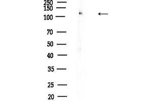 Western blot analysis of lysates from Mouse testis, using Phospho-FAK (Tyr576) Antibody at 1/1000 dilution.