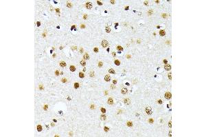 Immunohistochemistry (IHC) image for anti-Protein Arginine Methyltransferase 1 (PRMT1) (AA 20-353) antibody (ABIN3021312)