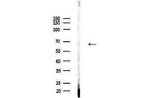 anti-Kelch-Like 3 (KLHL3) (N-Term) antibody