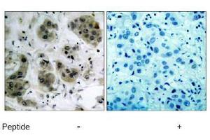 Image no. 1 for anti-V-Akt Murine Thymoma Viral Oncogene Homolog 1 (AKT1) (Ser473) antibody (ABIN197193) (AKT1 antibody  (Ser473))