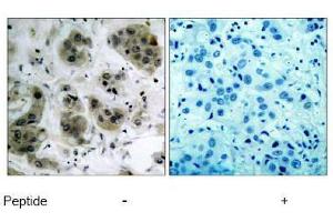 Image no. 1 for anti-V-Akt Murine Thymoma Viral Oncogene Homolog 1 (AKT1) (Ser473) antibody (ABIN197192) (AKT1 antibody  (Ser473))