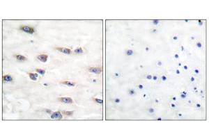 Immunohistochemical analysis of paraffin-embedded human brain tissue using Trk A (phospho-Tyr791) antibody. (TRKA antibody  (pTyr791))