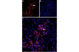Expression of VPAC1 in rat amygdala - Immunohistochemical staining of immersion-fixed, free floating rat brain frozen sections using Anti-VPAC1 (VIPR1) (extracellular) Antibody (ABIN7043875, ABIN7045329 and ABIN7045330), (1:100). (VIPR1 antibody  (Extracellular))