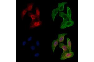 ABIN6257482 and ABIN6275890 staining Hela cells by IF/ICC.