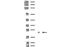 Western blot analysis of lysates from EC304 cells(heat-shock 45 min treatment), using RP/RP Antibody at 1/1000 dilution.