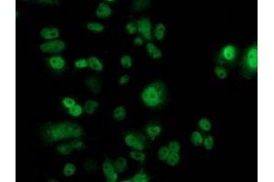 Anti-TP53 mouse monoclonal antibody (ABIN2454483) immunofluorescent staining of COS7 cells transiently transfected by pCMV6-ENTRY TP53 (RC200003). (p53 antibody)