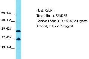 Host: Rabbit Target Name: FAM25E Sample Tissue: Human COLO205 Whole Cell Antibody Dilution: 1ug/ml (FAM25E antibody  (C-Term))