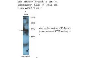 Image no. 1 for anti-Glial Cell Line Derived Neurotrophic Factor (GDNF) antibody (ABIN790851) (GDNF antibody)