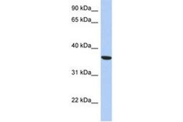 PSTK Antikörper  (AA 143-192)