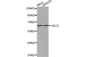 Western blot analysis of extracts of various cell lines, using AKT2 antibody.