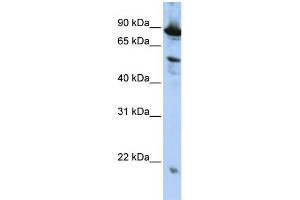 WB Suggested Anti-ZGPAT  Antibody Titration: 0. (ZGPAT antibody  (N-Term))