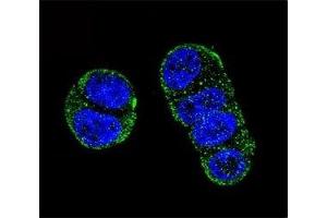 Confocal immunofluorescent analysis of PSMA antibody with ZR-75-1 cells followed by Alexa Fluor 488-conjugated goat anti-rabbit lgG (green). (PSMA antibody  (AA 161-190))
