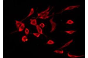 ABIN6276275 staining HepG2 by IF/ICC. (PTGDR antibody  (Internal Region))