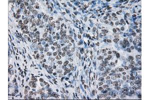 Immunohistochemical staining of paraffin-embedded colon tissue using anti-ID3mouse monoclonal antibody. (ID3 antibody)