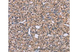 Immunohistochemistry of Human brain  using ADAM29 Polyclonal Antibody at dilution of 1:40 (ADAM29 antibody)