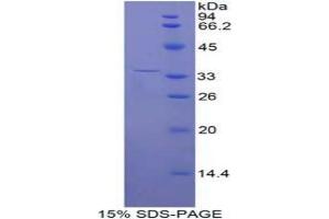 SDS-PAGE analysis of Human ENPP2 Protein.