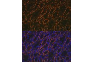 Immunofluorescence (IF) image for anti-alpha-Methylacyl-CoA Racemase (AMACR) (AA 1-198) antibody (ABIN3021498)