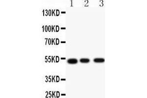 Anti-Muscarinic Acetylcholine Receptor 2 antibody, Western blotting All lanes: Anti Muscarinic Acetylcholine Receptor 2 () at 0.