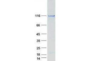 Validation with Western Blot