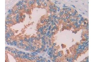Detection of CBG in Human Prostate Tissue using Polyclonal Antibody to Corticosteroid Binding Globulin (CBG) (SERPINA6 antibody  (AA 218-378))