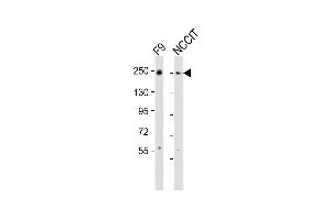 All lanes : Anti-PBRM1 Antibody (C-term) at 1:2000 dilution Lane 1: F9 whole cell lysates Lane 2: NCCIT whole cell lysates Lysates/proteins at 20 μg per lane. (Polybromo 1 antibody  (C-Term))