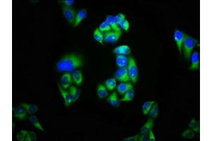 Immunofluorescence staining of Hela cells with ABIN7163932 at 1:100, counter-stained with DAPI. (KCNK3 antibody  (AA 278-379))
