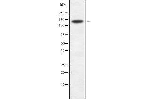Western blot analysis SPAG5 using Jurkat whole cell lysates (SPAG5 antibody  (Internal Region))