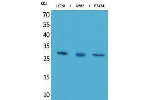 Western Blotting (WB) image for anti-Breast Cancer Metastasis-Suppressor 1-Like (BRMS1L) (C-Term) antibody (ABIN3178189) (BRMS1L antibody  (C-Term))