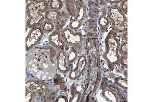 Immunohistochemical staining of human kidney with TMEM132C polyclonal antibody  shows cytoplasmic and membranous positivity in renal tubules. (TMEM132C antibody)