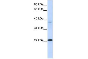 C11ORF74 antibody used at 1 ug/ml to detect target protein.