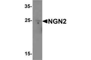 Western blot analysis of NGN2 in rat brain tissue lysate with NGN2 Antibody  at 1 μg/mL (Neurogenin 2 antibody  (C-Term))