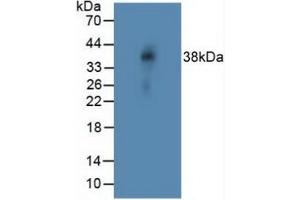 Western blot analysis of Rat Vein Tissue. (NOTCH4 antibody  (AA 1715-2001))