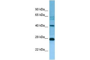 WB Suggested Anti-MRPL38 Antibody Titration: 1.
