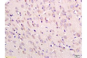 Formalin-fixed and paraffin embedded rat brain labeled with Anti-Tubulin-beta Polyclonal Antibody, Unconjugated (ABIN726320) at 1:200 followed by conjugation to the secondary antibody and DAB staining (TUBB antibody  (AA 1-50))