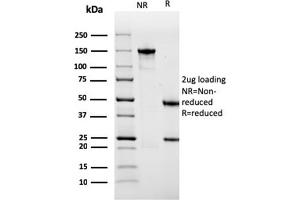 SDS-PAGE Analysis Purified Sarcomeric Actinin Alpha 2 Mouse MAb (ACTN2/3291). (ACTN2 antibody  (AA 557-692))