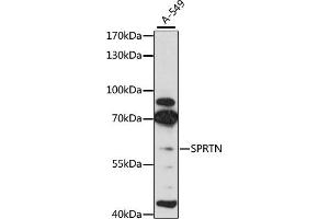 Western blot analysis of extracts of A-549 cells, using SPRTN antibody (ABIN6131456, ABIN6148389, ABIN6148391 and ABIN6215355) at 1:3000 dilution. (Spartan antibody  (AA 1-240))