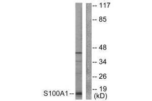 Western blot analysis of extracts from A549 cells, using S100 A1 antibody. (S100A1 antibody)