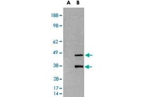 HEK293 overexpressing SIRT3 and probed with SIRT3 polyclonal antibody  (mock transfection in first lane), tested by Origene.