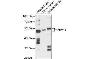 Western blot analysis of extracts of various cell lines, using RBM45 antibody (ABIN6128634, ABIN6146784, ABIN6146785 and ABIN6217980) at 1:3000 dilution. (RBM45 antibody  (AA 1-300))