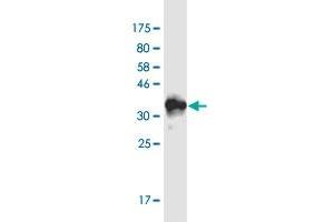 Western Blot detection against Immunogen (36. (RAI1 antibody  (AA 1-101))