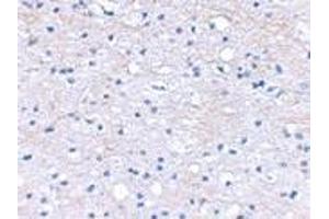 Immunohistochemical staining of human brain tissue using AP30163PU-N BRAL1 antibody at 2.