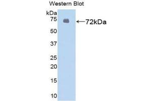 Detection of Recombinant HSPA1L, Human using Polyclonal Antibody to Heat Shock 70 kDa Protein 1 Like Protein (HSPA1L)