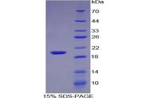 SDS-PAGE of Protein Standard from the Kit (Highly purified E. (IL-17 CLIA Kit)