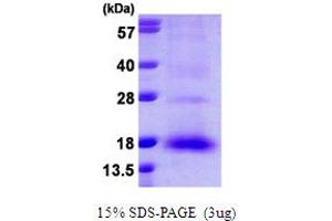 SDS-PAGE (SDS) image for NTF2-Related Export Protein 1 (NXT1) (AA 1-140) protein (His tag) (ABIN667905) (NXT1 Protein (AA 1-140) (His tag))