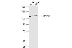 Lane 1: K562 lysates Lane 2: U937 lysates probed with HCAP G Polyclonal Antibody, Unconjugated  at 1:300 dilution and 4˚C overnight incubation. (NCAPG antibody  (AA 161-170))