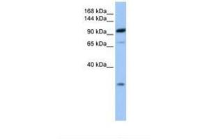 Image no. 1 for anti-Adaptor-Related Protein Complex 2, beta 1 Subunit (AP2B1) (AA 651-700) antibody (ABIN6738854) (AP2B1 antibody  (AA 651-700))